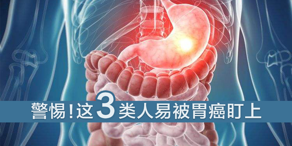 這3類(lèi)人易被胃癌盯上，及時(shí)補(bǔ)硒是關(guān)鍵
