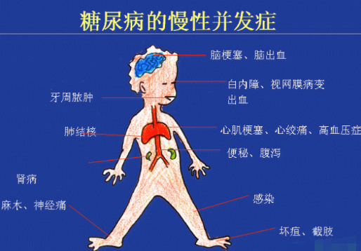 你還在害怕糖尿病嗎?科學(xué)補(bǔ)硒不“恐糖”