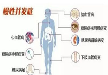 遠離高血糖并發癥，請記住一點，學會“補硒”